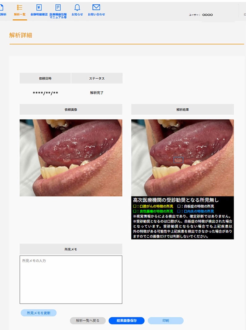 口腔がん早期治療へ…モリタ東京製作所が普及促進、画像解析システムの