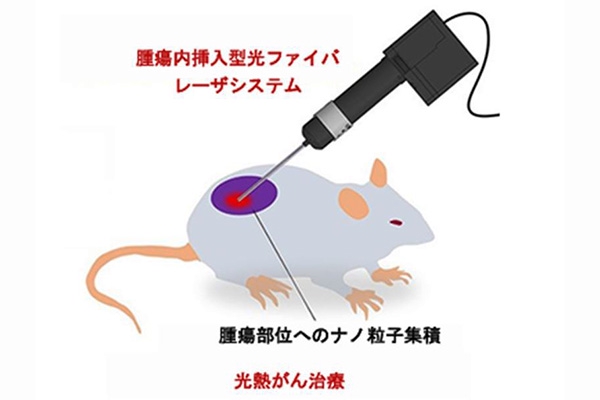 がん細胞を熱で破壊「光熱療法」実現へ新技術、東北大学が開発｜ニュー